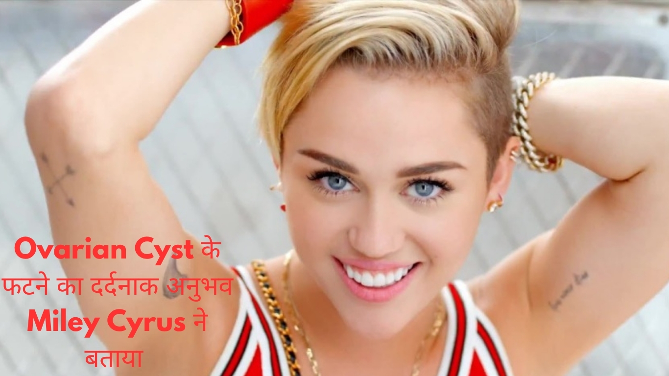 Ovarian Cyst